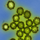 H1N1 virus particles under an electron microscope.